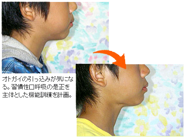 Ǘ摜