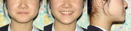 Ǘ摜